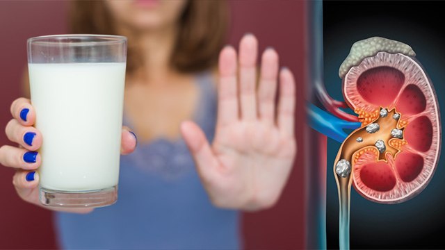 पथरी में दूध पीना चाहिए या नहीं | Kidney Stone me Milk peene se kya hota hai | Boldsky *health