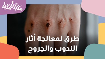كيف يمكن معالجة الندوب والاثار الناتجة عن العمليات والجروح؟