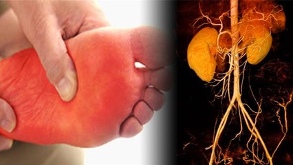 पैरों में जलन होना इस गंभीर बीमारी का लक्षण, तुरंत कराए जांच | Boldsky *Health