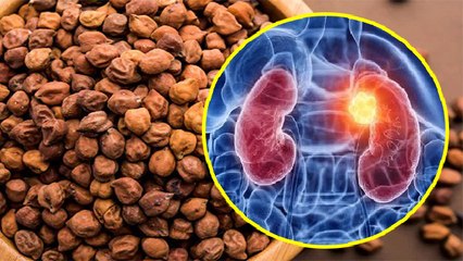 काले चने खाने से क्या होता है ।  काले चने खाने के नुकसान  । Boldsky *Health