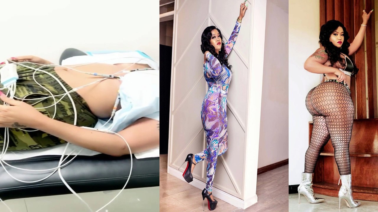 VERA SIDIKA butt reduction surgery part 1