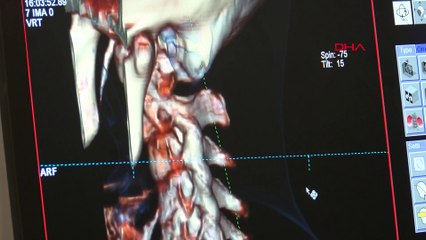 Aşırı cep telefonu kullananlarda 'Whatsappit' riski