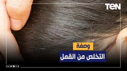 بمكونات طبيعية.. وصفة للوقاية والتخلص من "القمل"