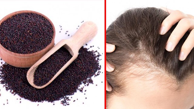 इस 1 चीज से बाल झड़ना होंगे बंद, क्या है लगाने का सही तरीका | Boldsky *Health