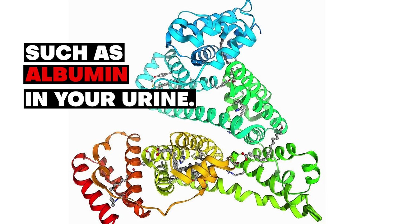 Is it NORMAL to have a FOAMY URINE: Cause and Treatment