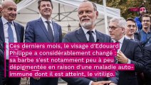 Edouard Philippe : après le vitiligo, l'ancien Premier ministre annonce être atteint d'une autre maladie