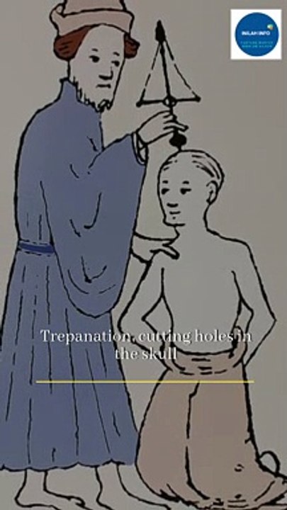 Trepanation, medical treatment or ritual to let demon out from the skull