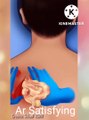 ASMR Giant Acne Removal - Armpit And Ear Deep Cleaning Animation @ArASMR
