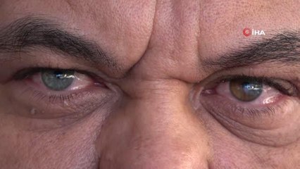 Sol gözü mavi ve kahverengi, sağ gözü yeşil