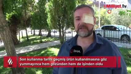 Tarihi geçmiş döner satmayı reddeden şef hem gözünden hem de işinden oldu