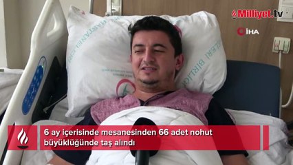 6 ay sonra büyük şok! Vücudu sürekli taş üretiyor