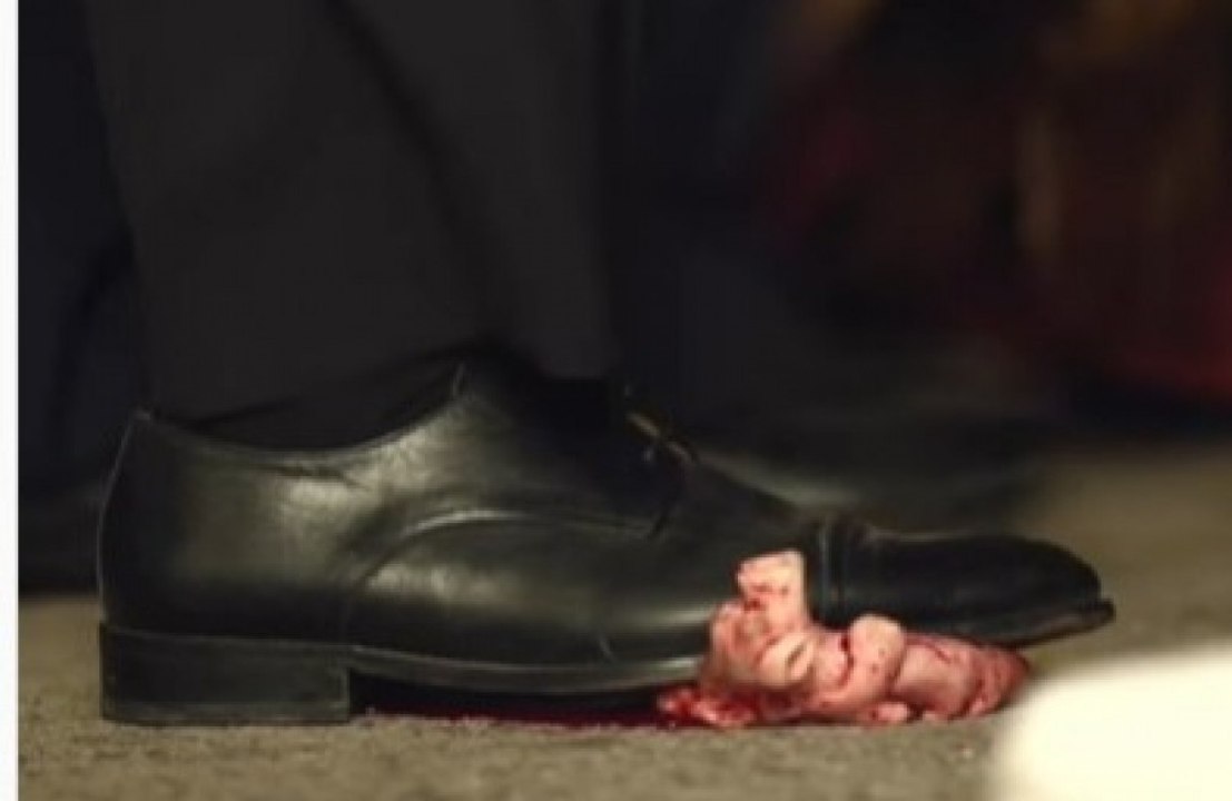 Shakira zeigt ihr gebrochenes Herz