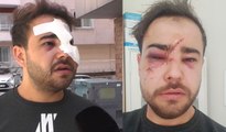 Hatay’da Onur Şener vakası yaşandı: İstediği parçayı çalmayan sokak müzisyeninin yüzünde içki şişesi kırdılar