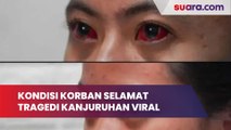 Seminggu Berlalu, Kondisi Korban Selamat Tragedi Kanjuruhan Masih Sakit Mata dan Sesak Nafas