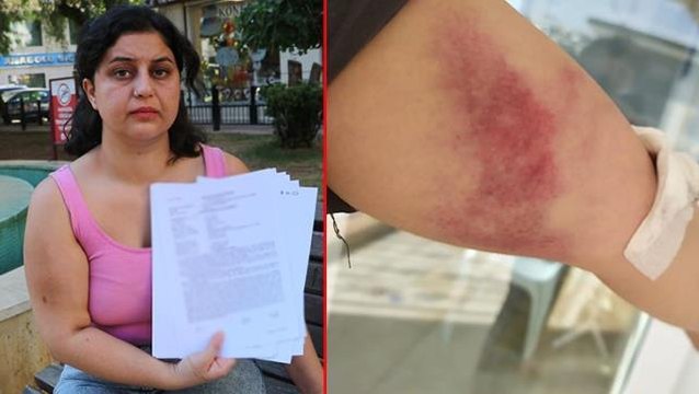 Hem sevgilisini darp etti, hem manevi tazminat davası açtı