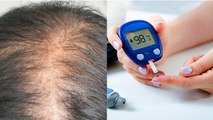 Diabetes में बाल क्यों झड़ते है | क्या डायबिटीज़ बाल झड़ने का कारण ? | Expert Advice | Boldsky *health