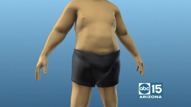 Phoenix Heart Partners with Enara Health to launch nation leading insurance covered weight loss program