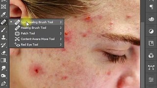 Magic of Spot Healing Brush Tool