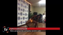 Dans yarışmasında yanlışlıkla kendini yaktı
