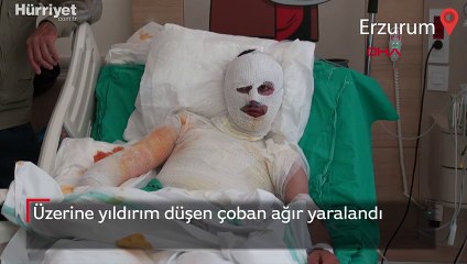 Erzurum'da üzerine yıldırım düşen çoban ağır yaralandı