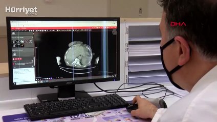 Ödüllü araştırma ilk kez ortaya çıkardı! Kovid-19, kalp ve kanserden koruyan sistemin 'şalterlerini' kapatıyor