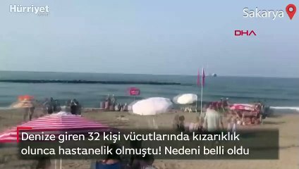 Sakarya Karasu’da kaşınmanın nedeni deniz anası
