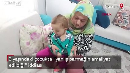 Çorum'da 'yanlış parmağın ameliyat edildiği' iddiası