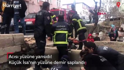 Küçük İsa'nın yüzüne demir saplandı