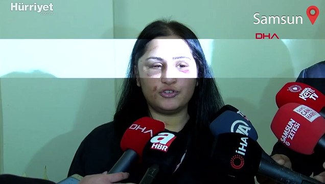 Samsun'da eski eşi tarafından sokak ortasında darbedilen kadın yaşadıklarını anlattı