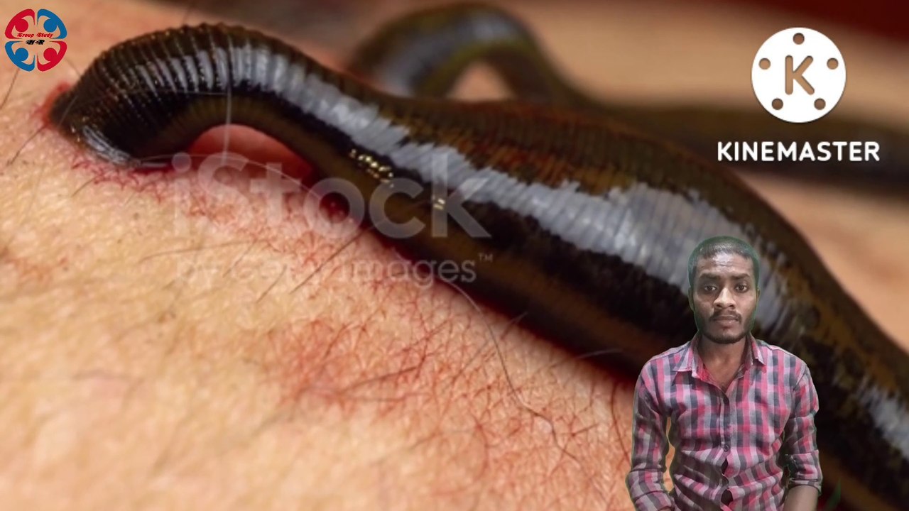 Why does a leech die by pouring salt on it? video Dailymotion