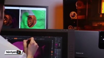 Yaşlı adam 3 boyutlu yazıcı sayesinde silikon çenesine kavuştu
