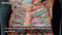 Corona virüs bulunan akciğerin 3D görüntüsü yayınlandı