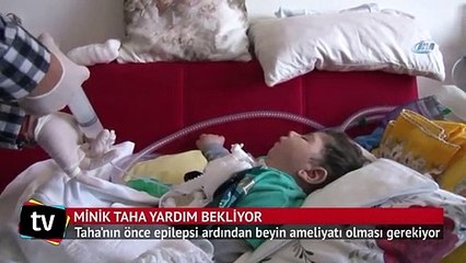Minik Taha'nın 5 ayrı makineye bağlı hayat mücadelesi