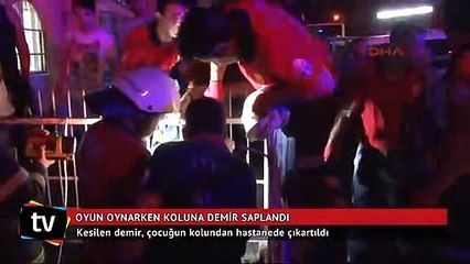 Oyun oynarken koluna demir saplandı