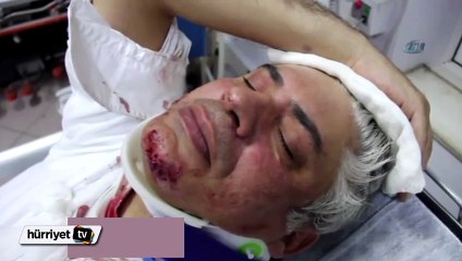 Hemşire doktoru hastanelik etti