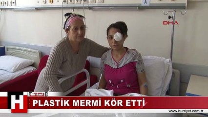 PLASTİK MERMİ KÖR ETTİ İDDİASI
