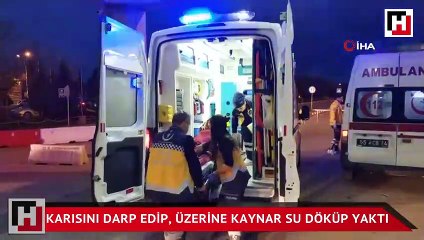 Karısını darp edip, üzerine kaynar su döküp yaktı