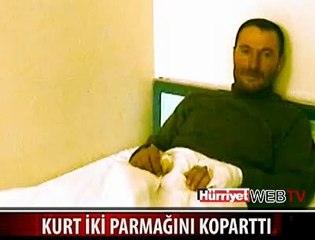 KURT 2 PARMAĞINI KOPARTTI