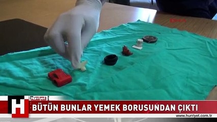 YEMEK BORUSUNDAN KOL SAATİ ÇIKTI