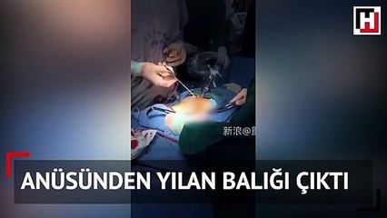 Anüsünden yılan balığı çıktı