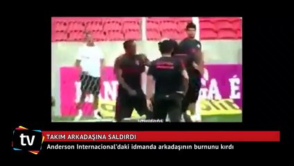 Anderson takım arkadaşının burnunu kırdı