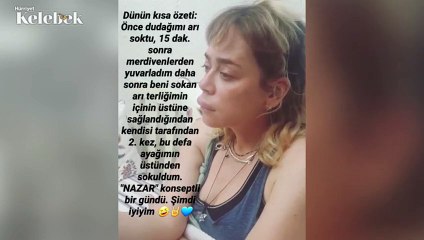 Demet Evgar'ın Dudağına Arı Soktu