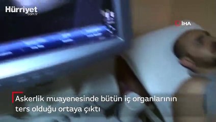 Askerlik muayenesinde bütün iç organlarının ters olduğu ortaya çıktı