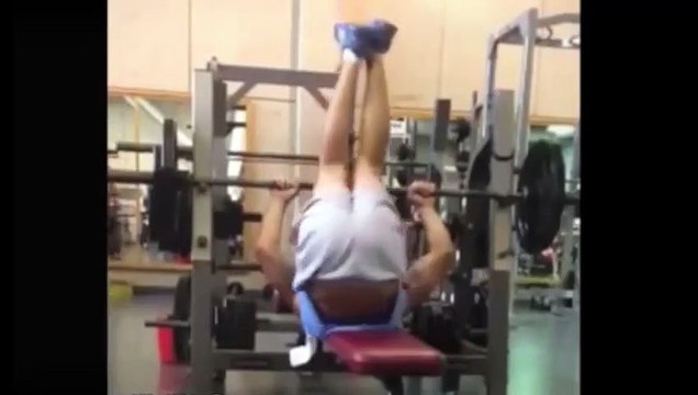 Vaser Liposuction - Şekillendirilmiş Liposuction