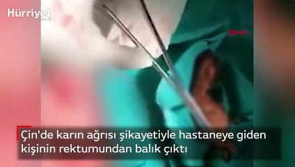 Çin'de karın ağrısı şikayetiyle hastaneye giden kişinin rektumundan balık çıktı