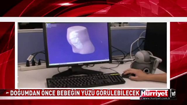 DOĞUM ÖNCESİ BEBEĞİN YÜZÜNÜ GÖRMEK ARTIK MÜMKÜN