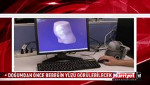 DOĞUM ÖNCESİ BEBEĞİN YÜZÜNÜ GÖRMEK ARTIK MÜMKÜN
