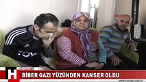 BİBER GAZI YÜZÜNDEN KANSERE YAKALANDI