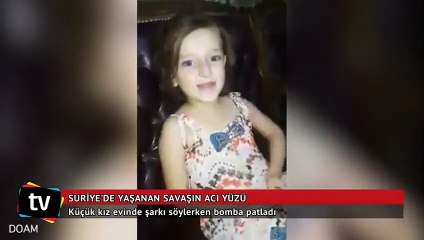 Suriye’de yaşanan savaşın acı yüzü