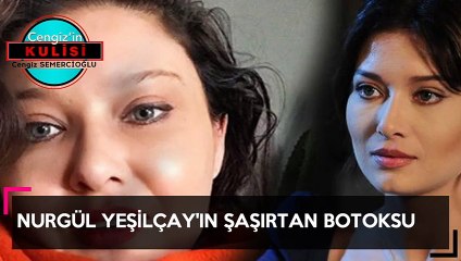 Nurgül Yeşilçay'ın şaşırtan botoksu-Cengiz'in Kulisi